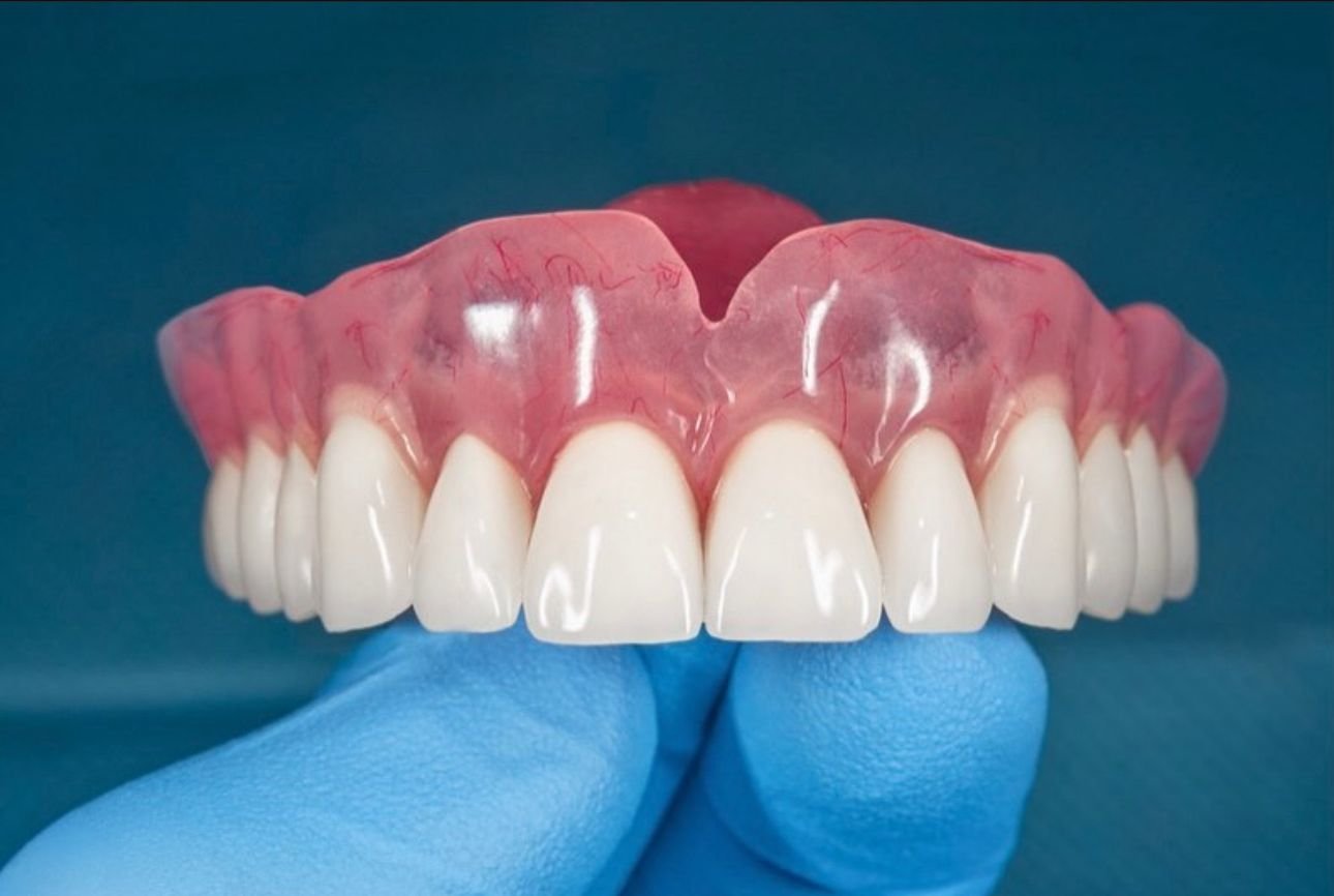 Prótesis dental CAD/CAM